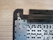 @ORIGINAL ASUS X540 ÜST KASA X540SA ÜST KASA 13NB0B01AP0401