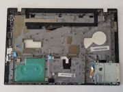 @ORIGINAL Lenovo ThinkPad T460p ÜST KASA SCB0K83779