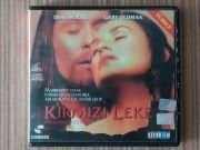 @ORIGINAL Kırmızı Leke VCD